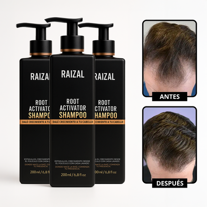RAIZAL™ - Shampoo Activador de Raices Capilares