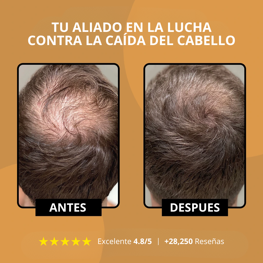 RAIZAL™ - Shampoo Activador de Raices Capilares