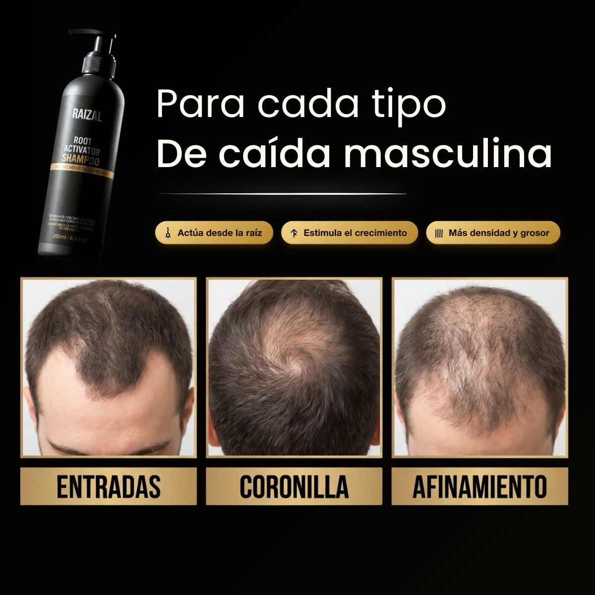 RAIZAL™ - Shampoo Activador de Raices Capilares