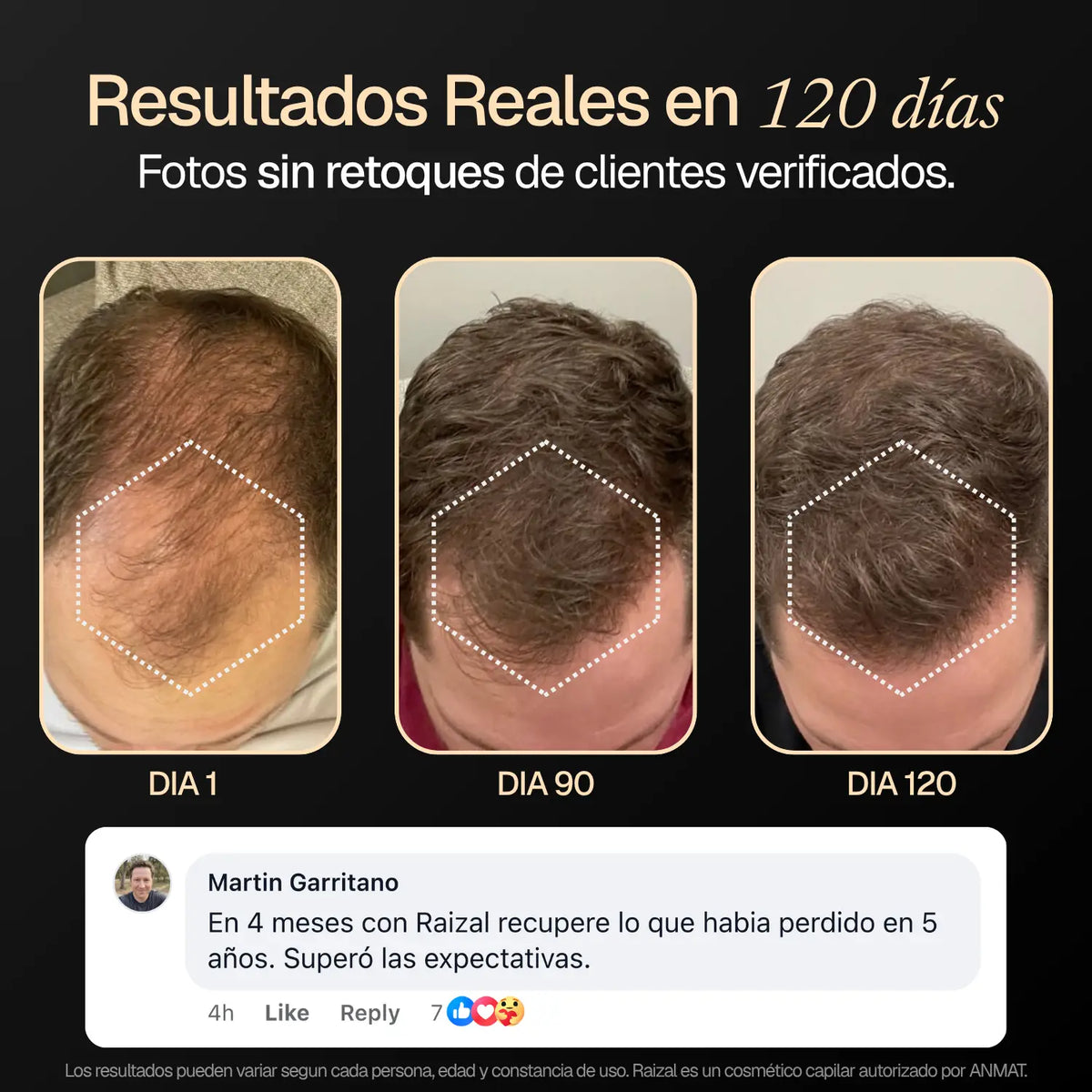 RAIZAL™ - Shampoo Activador de Raices Capilares