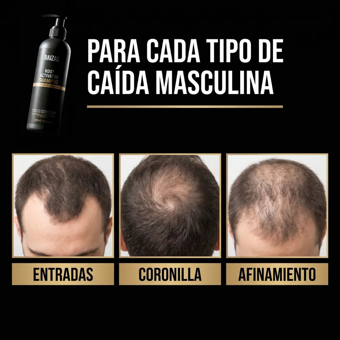 RAIZAL™ - Shampoo Activador de Raices Capilares