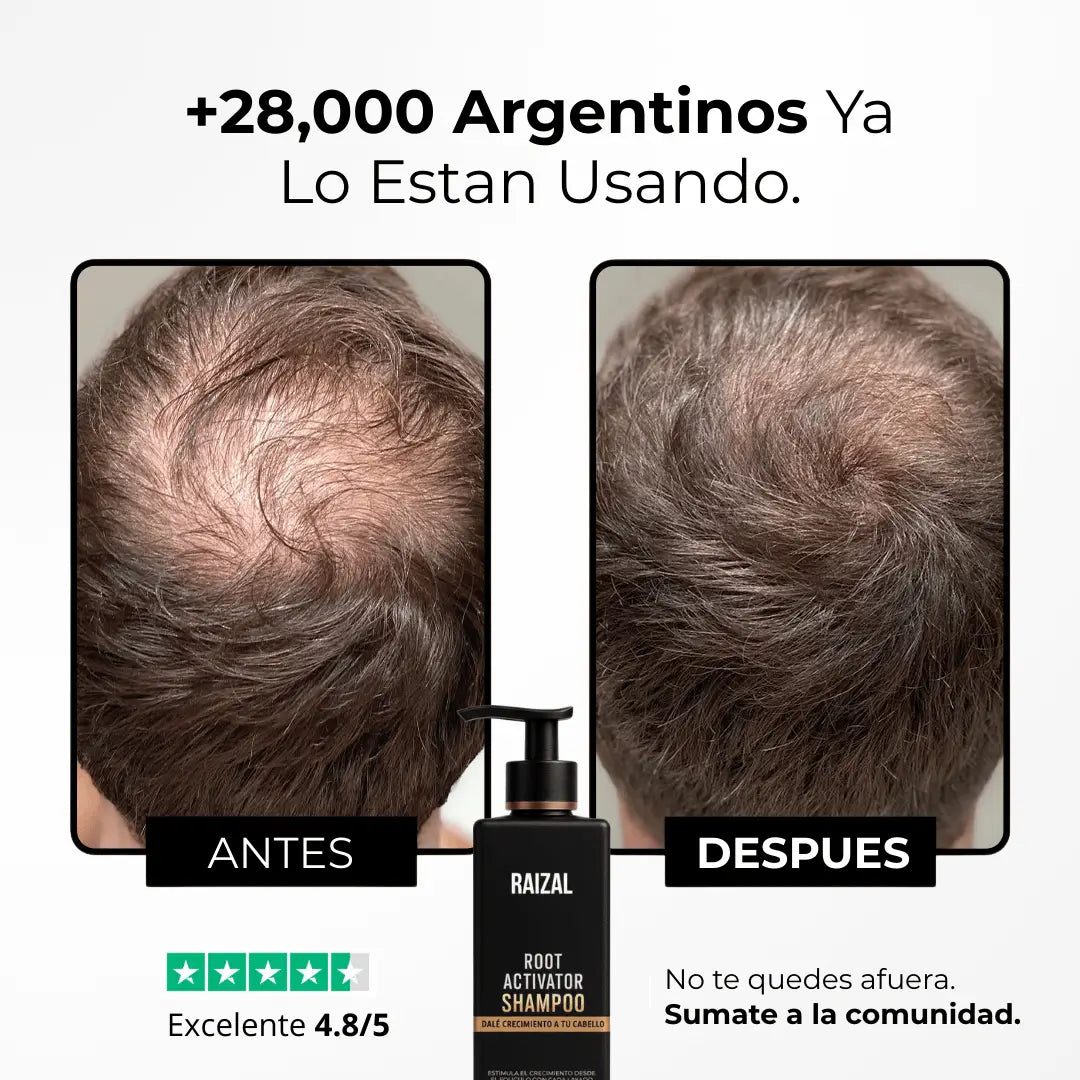 RAIZAL™ - Shampoo Activador de Raices Capilares