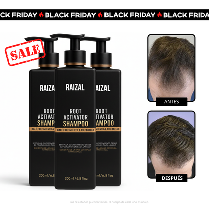 RAIZAL™ - Shampoo Activador de Raices Capilares