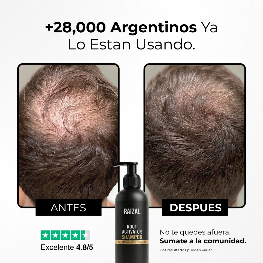 RAIZAL™ - Shampoo Activador de Raices Capilares